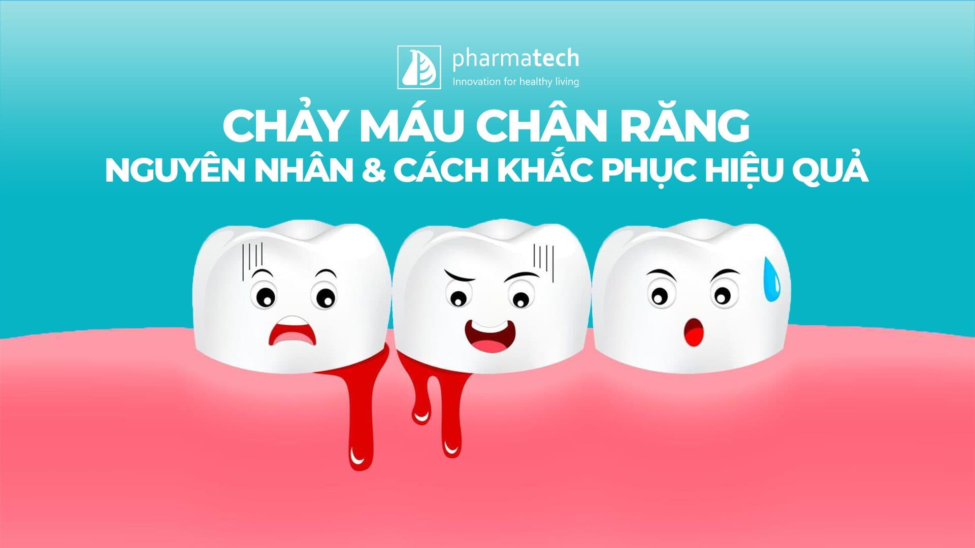 CHẢY MÁU CHÂN RĂNG &#8211;  NGUYÊN NHÂN &amp; CÁCH KHẮC PHỤC HIỆU QUẢ